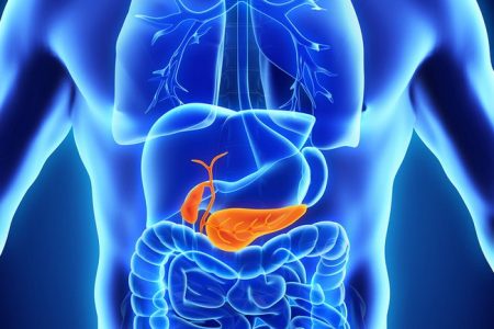 pancreatic | stones | health