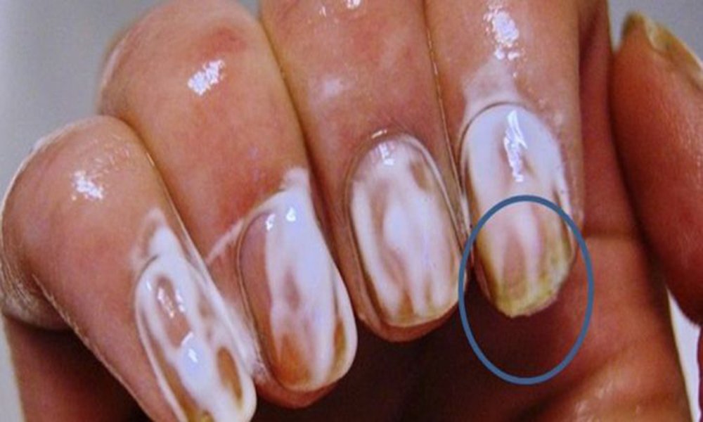 Rub Some Baking Soda On Your Nails And Watch What Happens