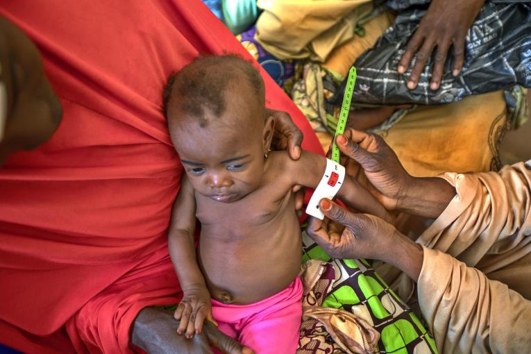 Malnutrition photo UNICEF