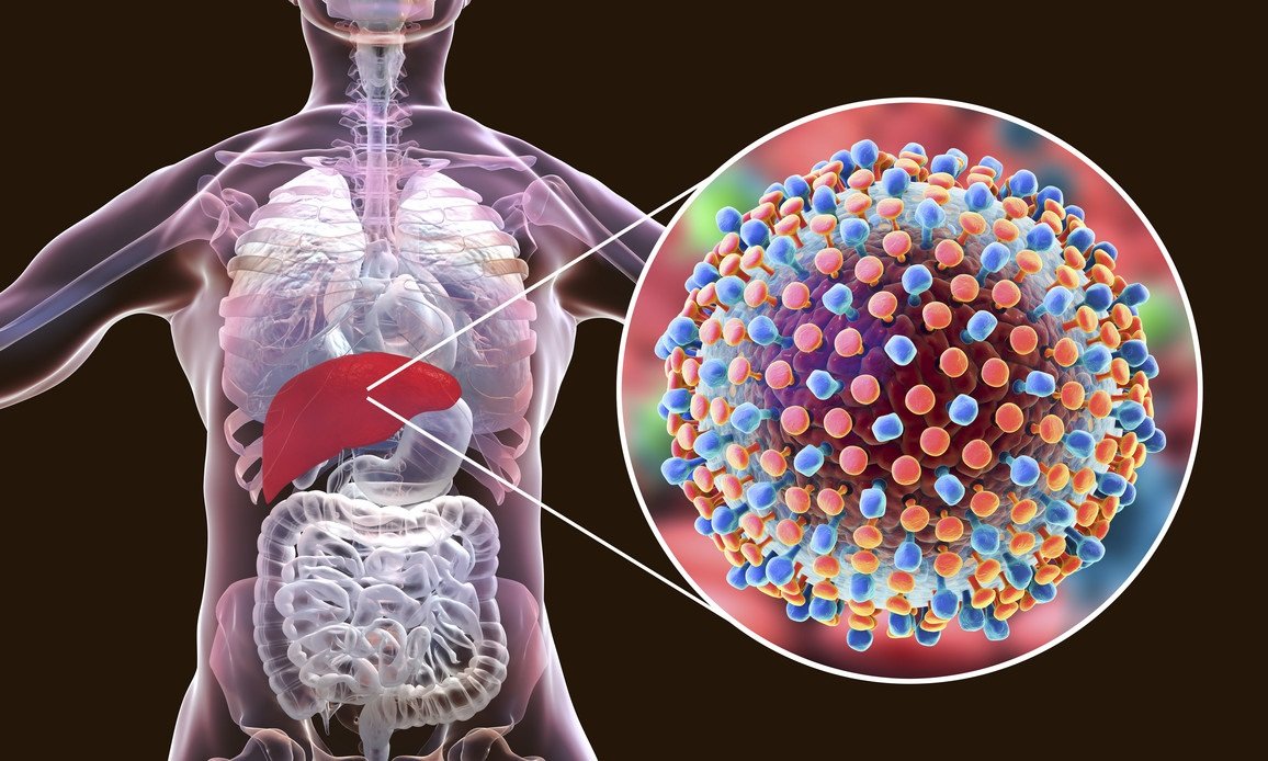 Hepatitis infection responsible for 13 lakh deaths worldwide every year