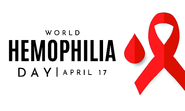 Hemophilia A rare genetic disease that affects the blood's ability to clot