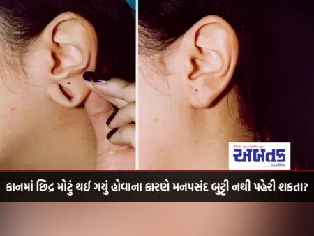 Can't wear your favorite earrings because of an enlarged ear hole?