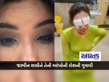 Jasmin Bhasi lost her eyesight, keep these things in mind while wearing contact lenses