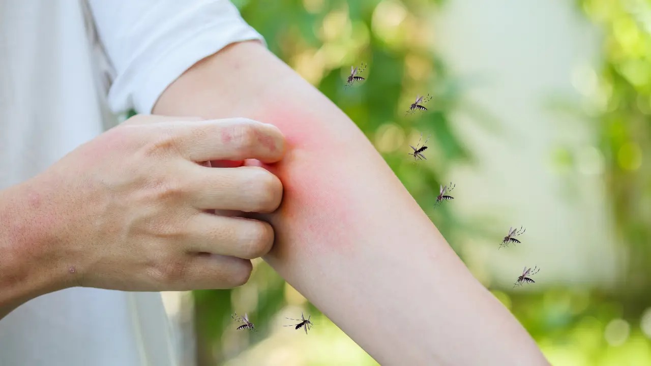 World Mosquito Day: Know, Why is it celebrated?