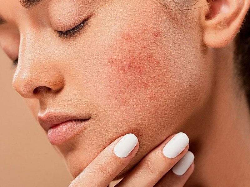 This remedy is beneficial for beautiful skin