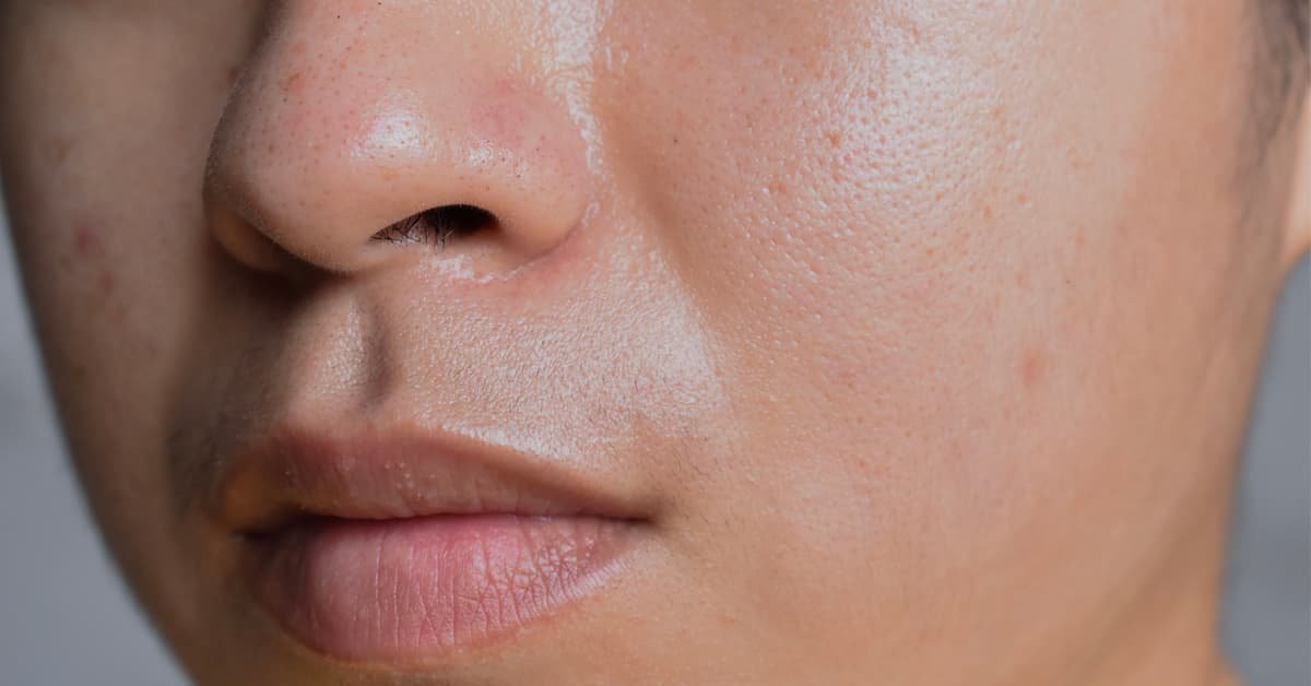 This remedy is beneficial for beautiful skin