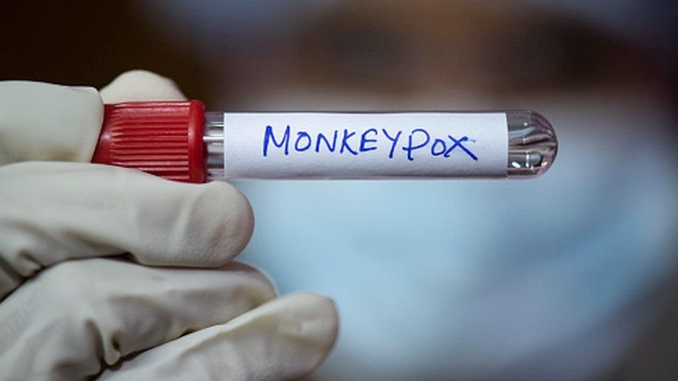 Can monkeypox spread in India too?