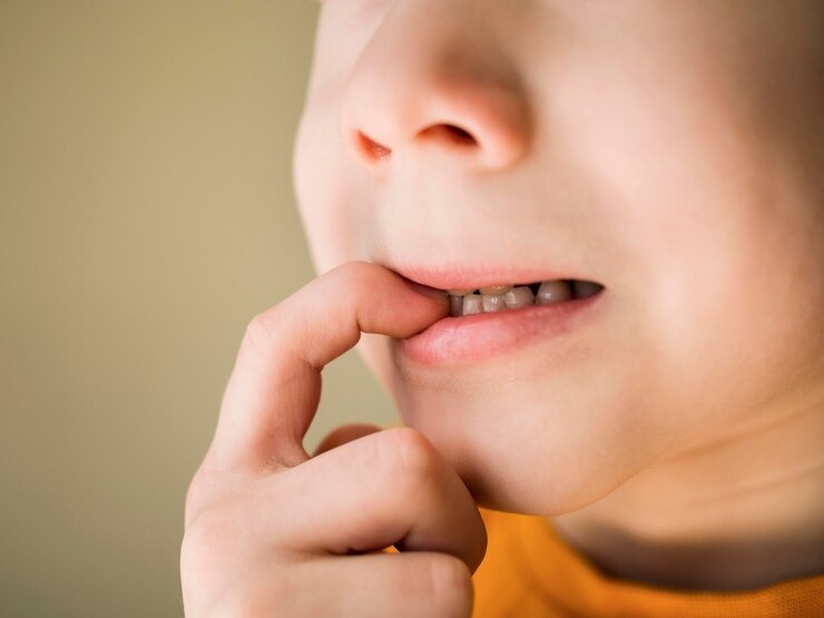 What causes white spots on children's teeth?