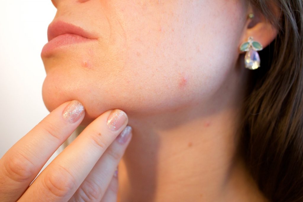 Dos and don'ts to protect skin from bacteria