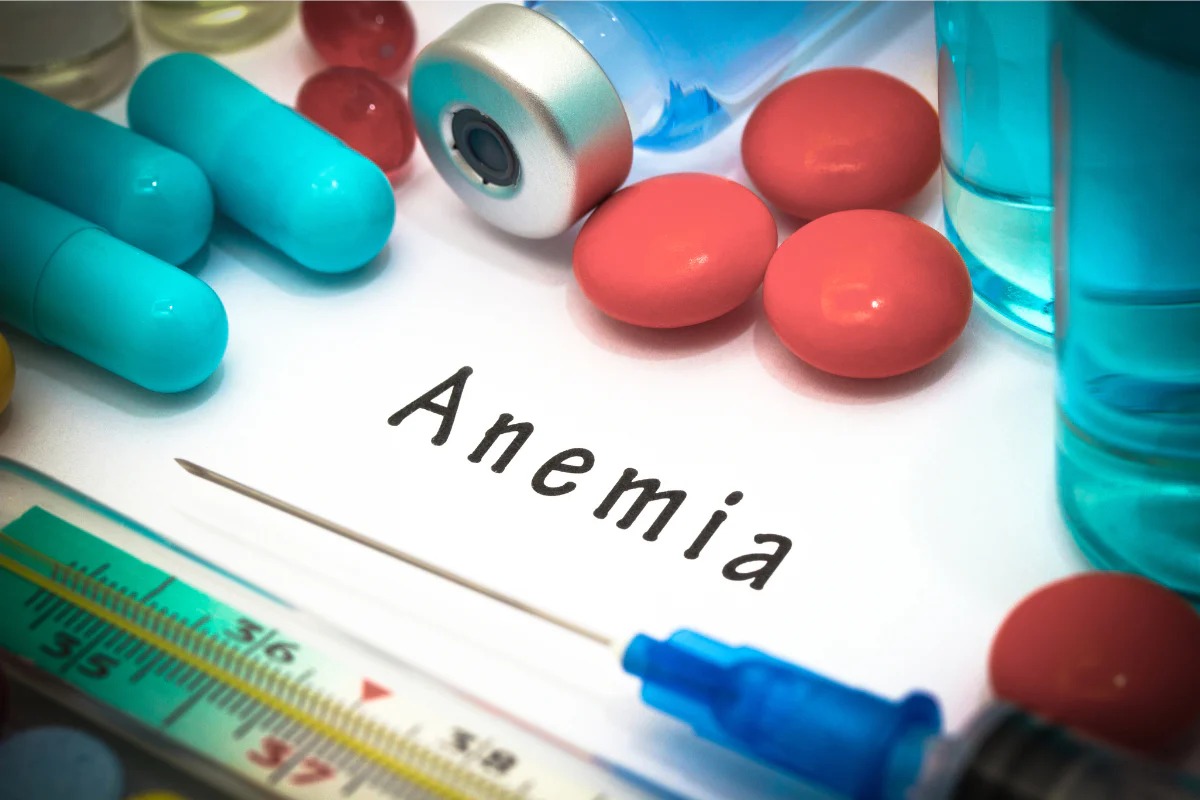 ANEMIA