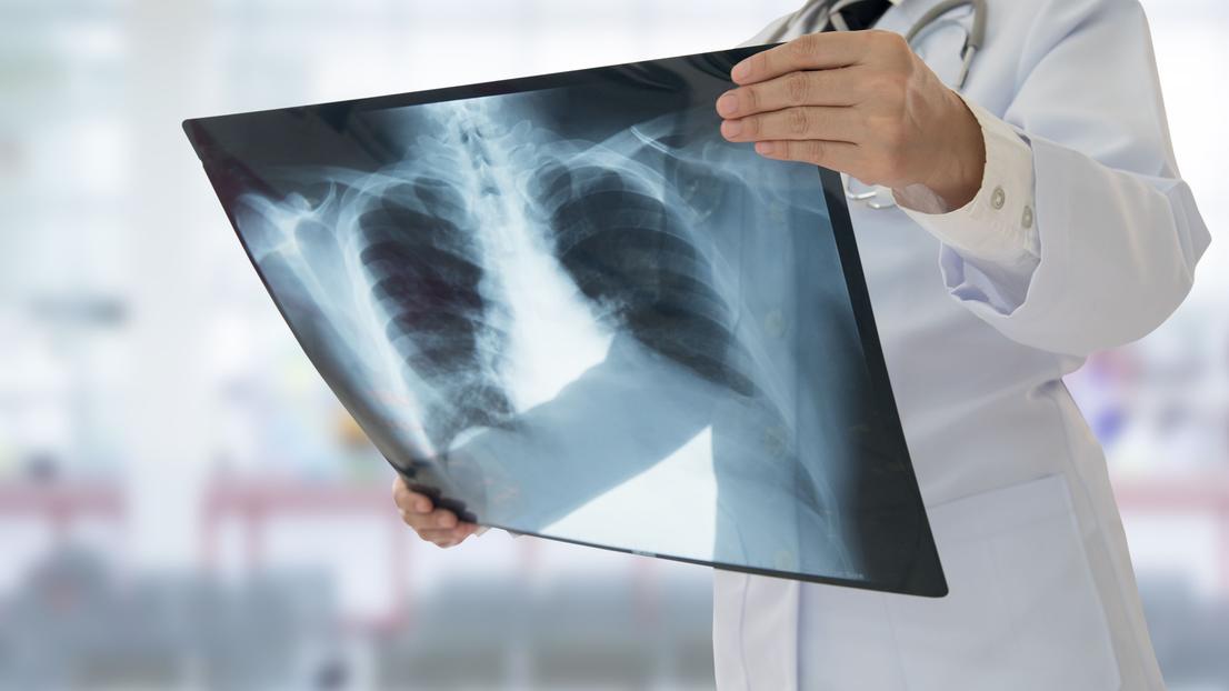 World Radiography Day 2024 : Know, when radiography may be needed?