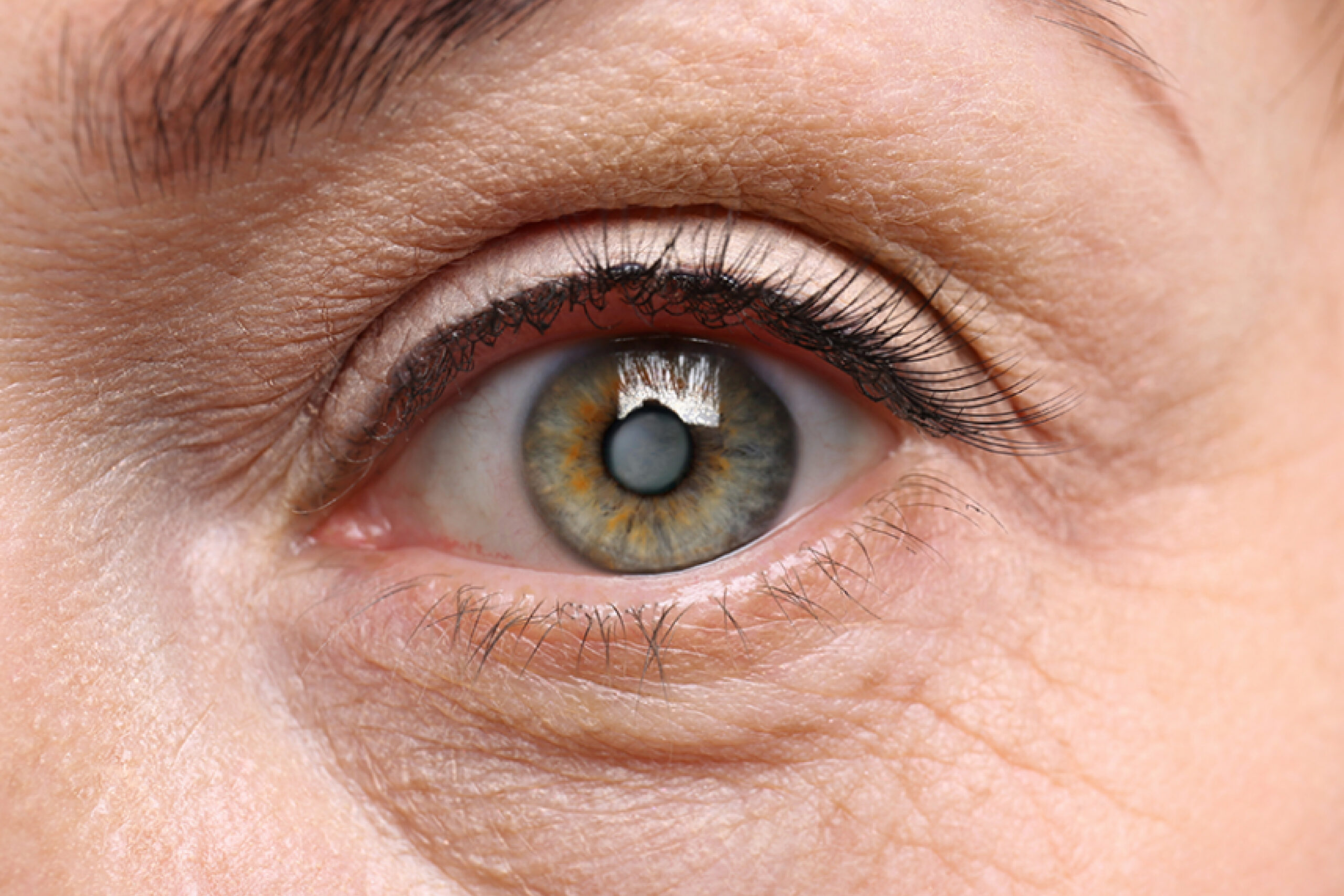 Are your eyes starting to age prematurely? Then follow these tips to improve your eyesight.